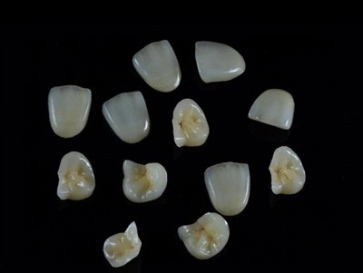 Cara Memilih Gam Pergigian Terbaik untuk Mahkota: Panduan Terkini