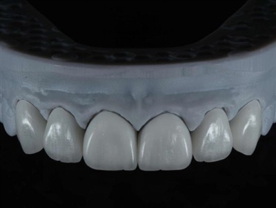 Cara Menyumber Luar Juruteknik Makmal Pergigian Bekerja di Luar Negara: Pandu...