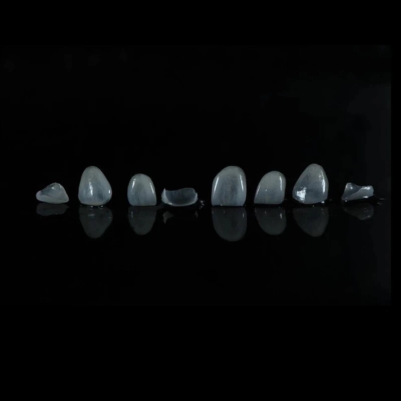 Feldspathic Veneers Feldspathic Veneers