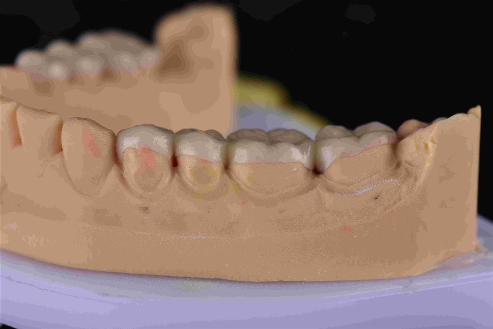 EMAX overlay EMAX overlay